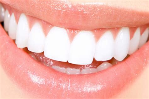 Experience a Whiter, Brighter Smile with Valley Dental Esthetics.